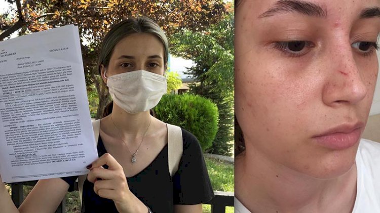 Şort giydiği için darp edilen kadın: 'Sen bunu giyemezsin, ben sana karışırım' diyerek vurdu