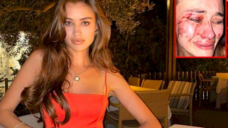 Ukraynalı modelin darp olayında sürpriz tanık ortaya çıktı!