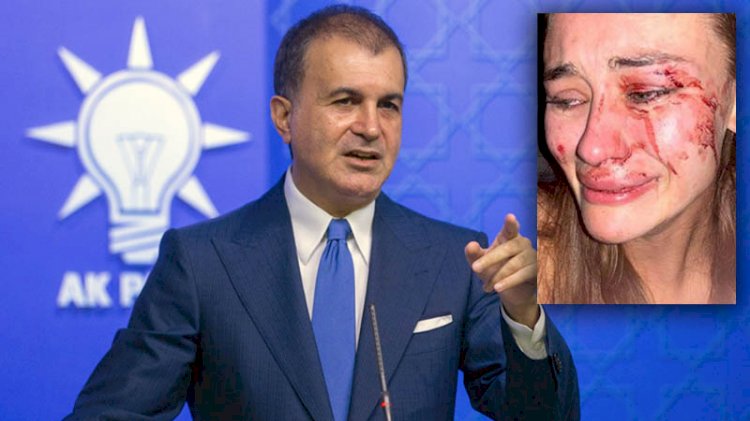 AKP'den 'Ukraynalı modele darp' açıklaması
