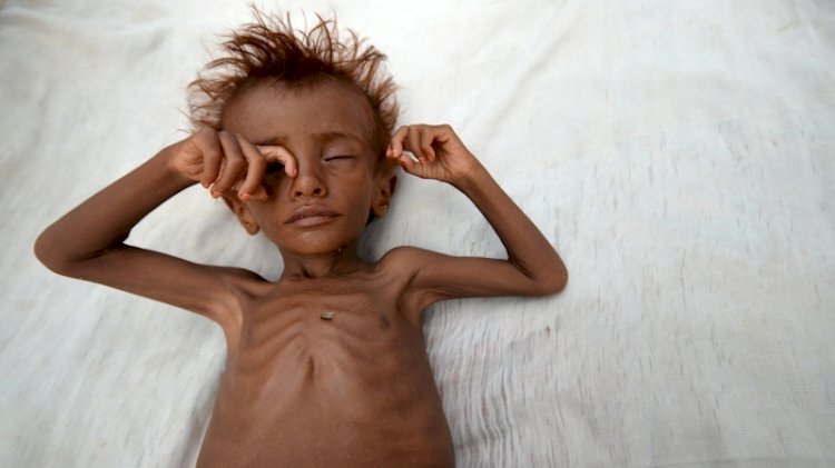 Yemen'de 10 milyon insan açlıkla burun buruna