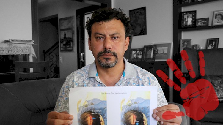 Kalp cerrahına meslektaşı tarafından saldırı