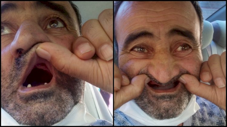 Hastanede dişleri kayboldu... 'Hastalıktan değil açlıktan ölecek'