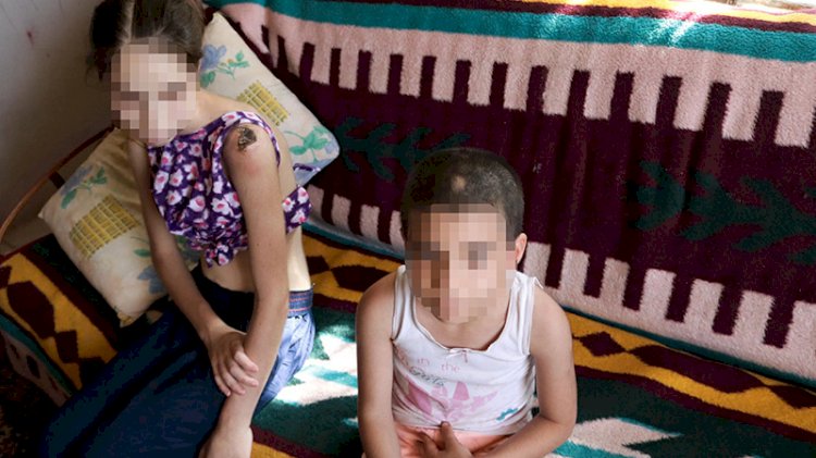 Üvey babadan abla kardeşe keser saplı işkence