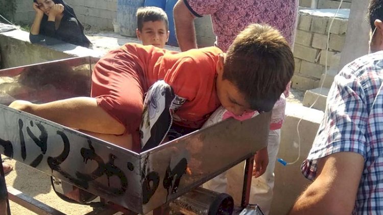 Çocuğu elinin şıkıştığı salça makinasıyla hastaneye taşıdılar