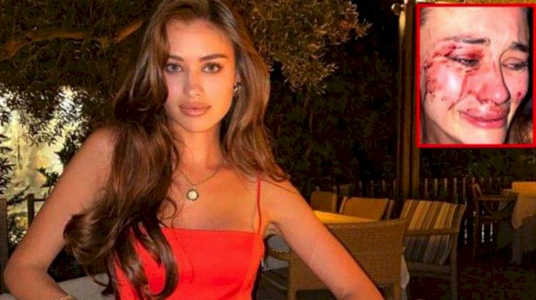 Çeşme'de darp edilen Ukraynalı modelin soruşturmasında yeni gelişme