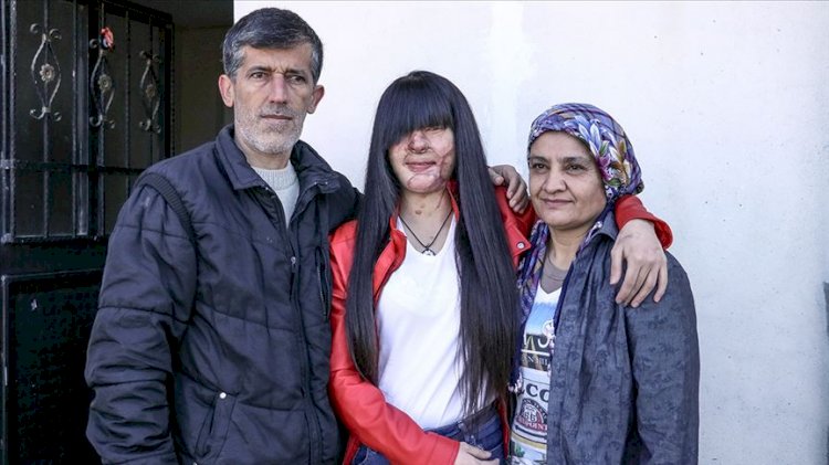 Yüzüne asit atan eski erkek arkadaşını affeden Berfin Özek: 'Bunu nasıl yapabildim?'