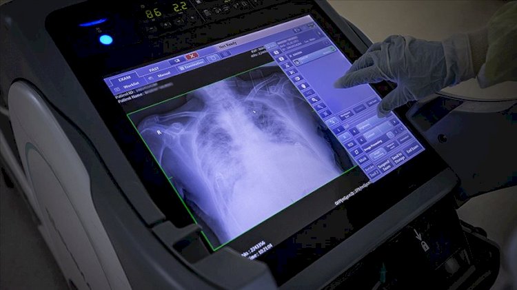 7 Eylül Türkiye'deki koronavirüs tablosu açıklandı