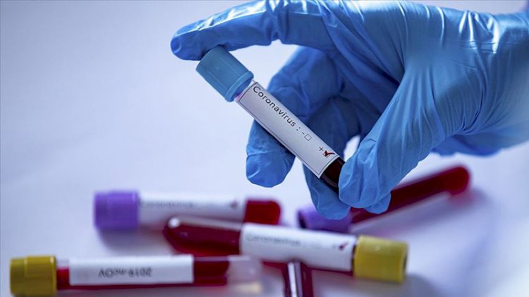 Günlük koronavirüs tablosu açıklandı