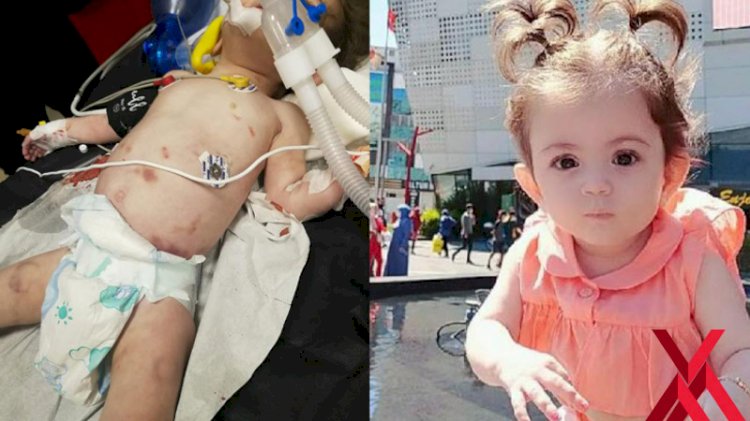 'Hayat' bebek hayatını yaşayamadı: İşkence ile öldürüldü!