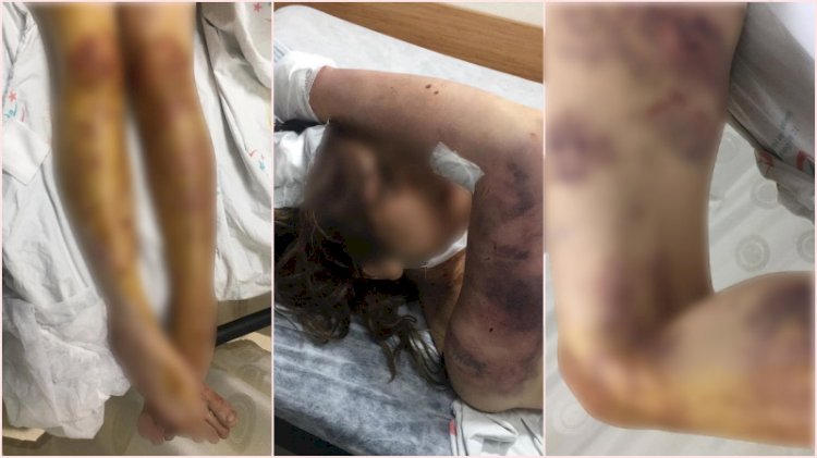 Caniliği kan dondurdu! Günlerce zincirle dövdü, tırnaklarını söktü
