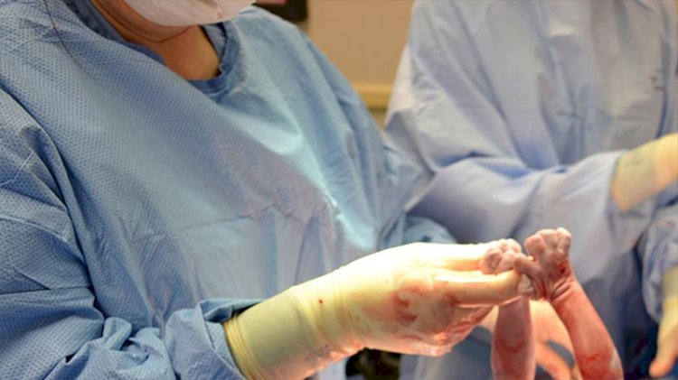 Her 16 saniyede bir bebek ölü doğuyor