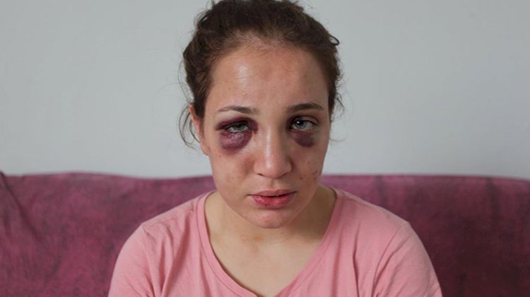 Eşini darp edip serbest kalan koca: Ne oldu beni tutuklatabildiniz mi?