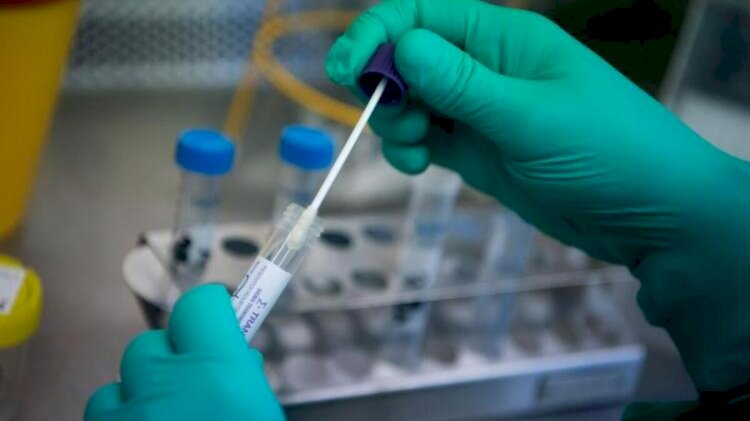 İki test aynı anda yapılabilecek