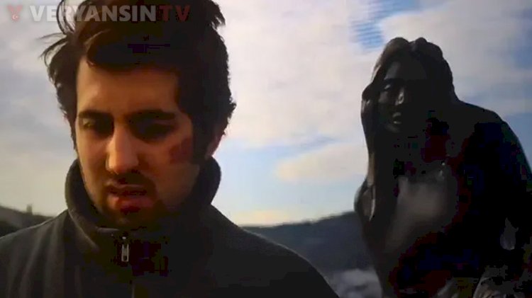 Tivibu heykelin memelerini sansürledi