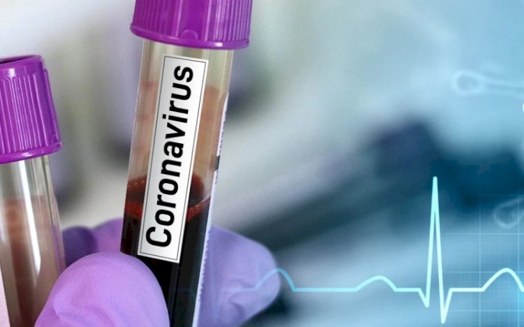 Bakanlık vatandaşlardan gelen Kovid-19 sorularını açıkladı