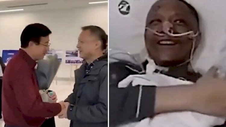 Koronavirüs sonrası ten rengi değişen doktorun son hali
