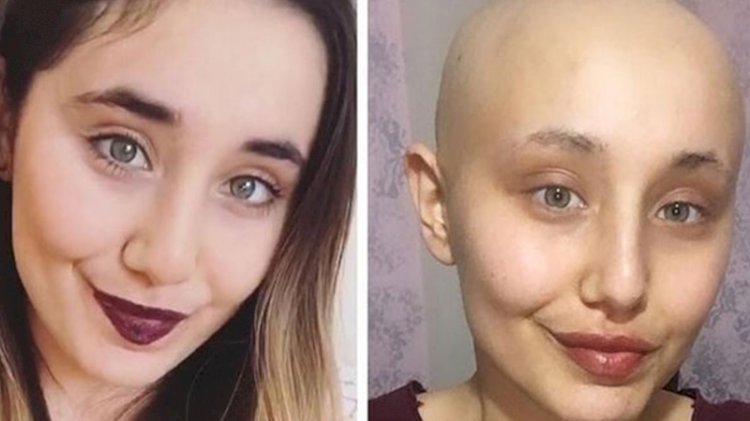 Kanser tedavisi gören Ayyüce'den kötü haber