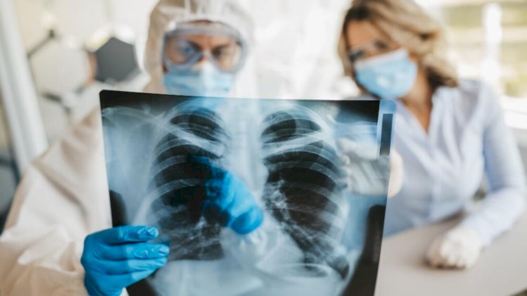 Yeni tarama tekniği, KOVID-19'un akciğerlerde oluşturduğu hasarı gösterdi