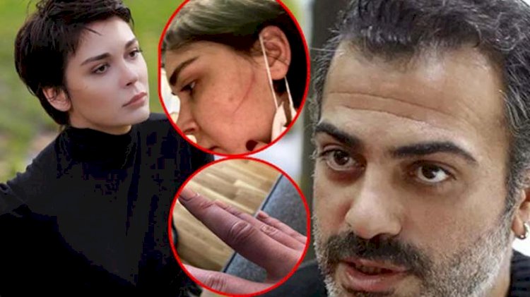 Sermiyan Midyat'ın Sevcan Yaşar'a darp davasında yeni gelişme