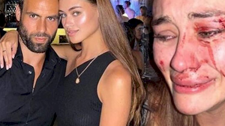 Çeşme'deki mekanda gerçekleşen darp olayında şaşırtan gelişme