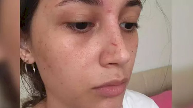 20 yaşındaki genç kadını şort giydiği için darp eden 71 yaşındaki adamdan skandal savunma