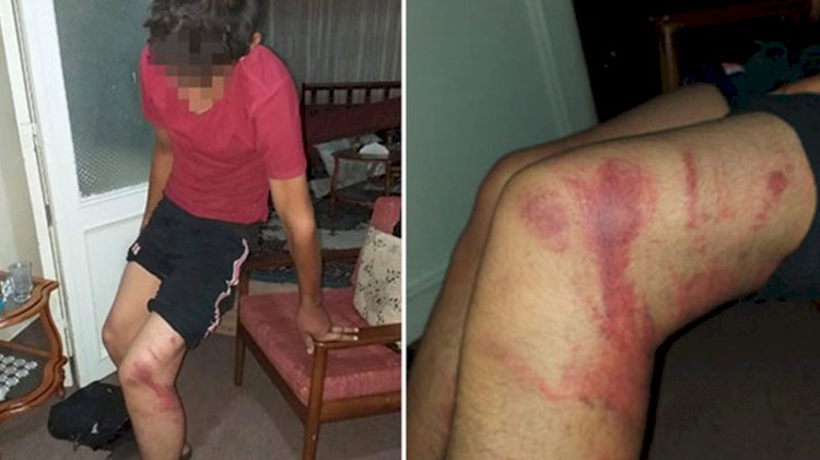 Ustanın çırağını dövdüğü triger kayışı, 'silah' sayıldı: Cezası belli oldu