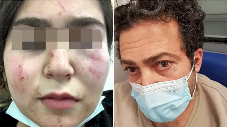 Almanya'da polis Türk aileyi hastanelik etti