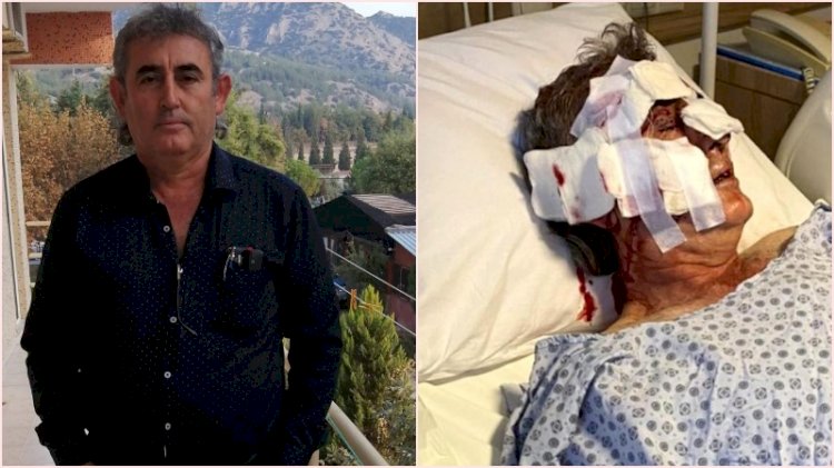 Antalya'da maymun dehşeti: Otel görevlisini yemeye kalktı