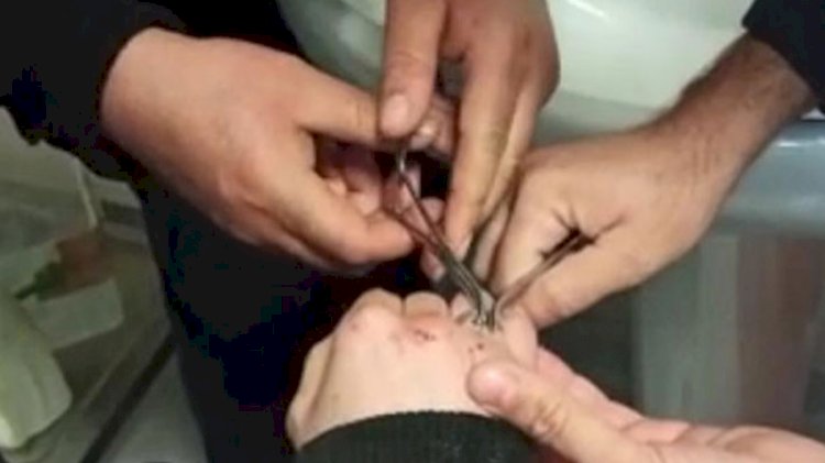 Parmağına sıkışan yüzüğü itfaiye çıkardı