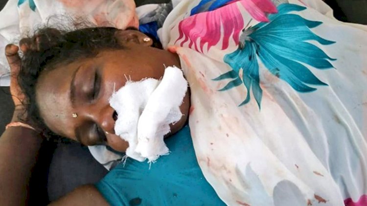 Seçim için söz vermişti: Kazanınca dilini kesti