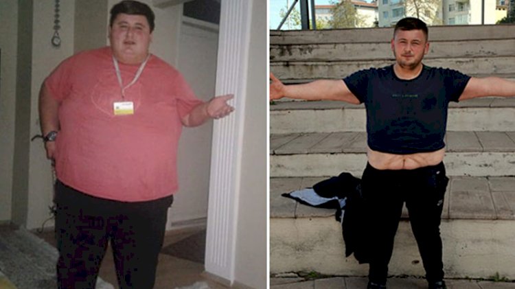 Azmin böylesi! Sevgilisi beğenmeyince 212 kilo verdi