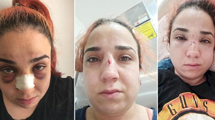 Kadın çalışandan patronuna 'süpürgeyle dövdü' suçlaması