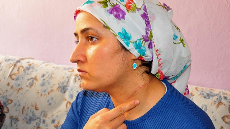 'Eşi yaralama' davasında hakim: Burası Taliban mahkemesi değil