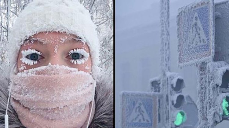 -40 derecede mini etekle sokağa çıkan genç kız, eve geldiğinde bacağını görünce çığlık attı