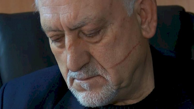 Cengiz Kurtoğlu'nun saldırdığını iddia etmişti... Mustafa Can ilk kez konuştu