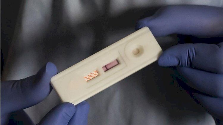 'Kovid'den farkı yok'... AIDS yayılıyor!